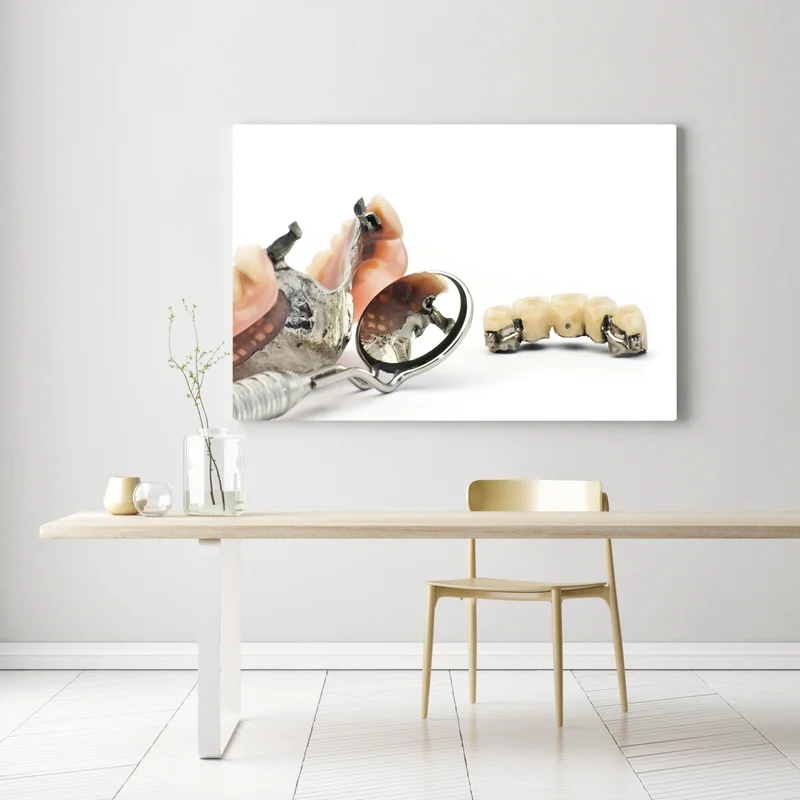 Leinwandbild kombinierte feste und mobile Prothese • Leinwandbilder bei Wallnifity® Leinwandbild kombinierte feste und mobile Prothese • Leinwandbilder bei Wallnifity®